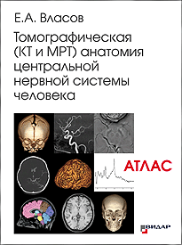 Томографическая (КТ и МРТ) анатомия центральной нервной системы человека. Атлас.