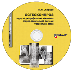 ЖАРКОВ ОСТЕОХОНДРОЗ И ДРУГИЕ ДИСТРОФИЧЕСКИЕ ИЗМЕНЕНИЯ СКАЧАТЬ БЕСПЛАТНО ЖАРКОВ ОСТЕОХОНДРОЗ И ДРУГИЕ ДИСТРОФИЧЕСКИЕ ИЗМЕНЕНИЯ СКАЧАТЬ БЕСПЛАТНО