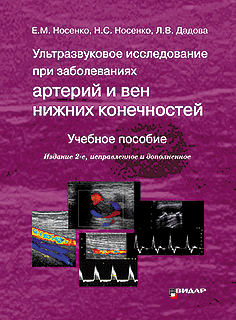 ПОДПИСКА: Ультразвуковое исследование при заболеваниях артерий и вен нижних конечностей. Издание 2-е, исправленное и дополненное