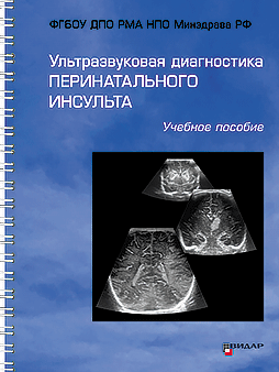 ПОДПИСКА. Ультразвуковая диагностика перинатального инсульта.