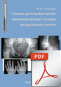 FILE: Клинико-рентгенологические изменения крупных суставов при дисплазиях скелета