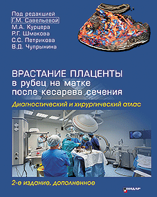Врастание плаценты в рубец на матке после кесарева сечения. Диагностический и хирургический атлас. Издание 2-е, дополненное.