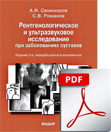 FILE: Рентгенологические и ультразвуковые исследования при заболеваниях суставов. Изд.3-е
