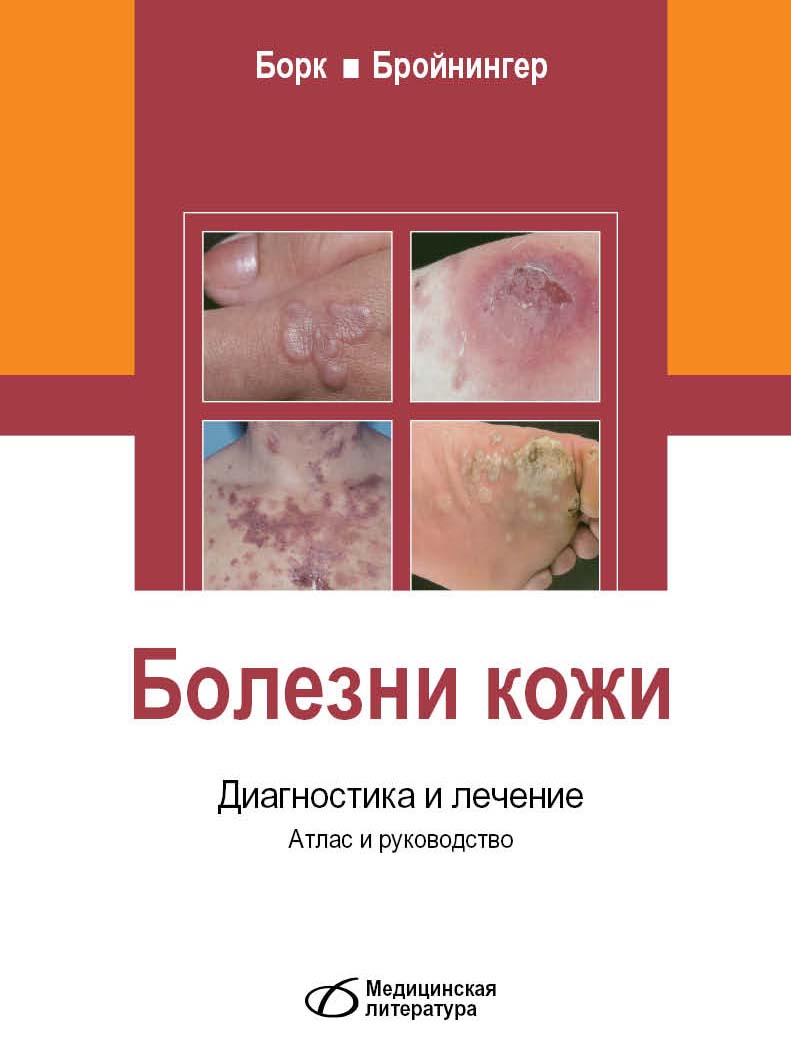 Atlas de dermatologia fotos 1 Atlas de dermatologia fotos 26